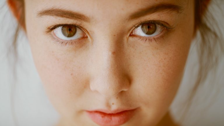 Can the Right Diet Get Rid of Acne?