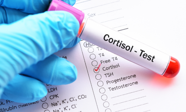 What to Know About Low Cortisol