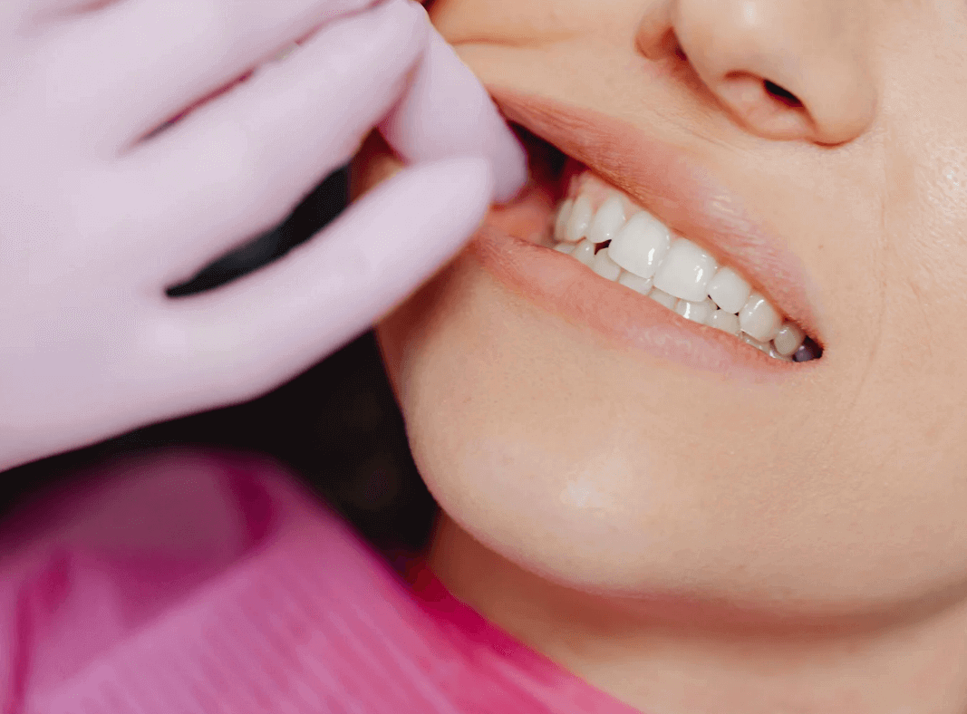 What Every Mom Should Know About Wisdom Teeth and Teen Oral Health Kelly Bejelly tooth extraction
