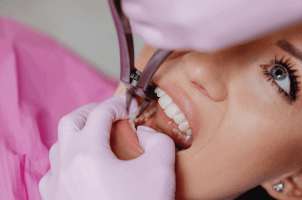 tooth extraction