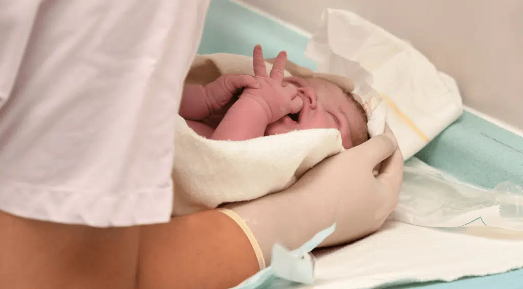 Caring for a Baby With Erb's Palsy at Home