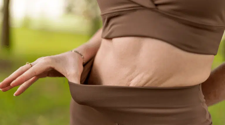 What Diet and Exercise Can and Cannot Fix After Pregnancy
