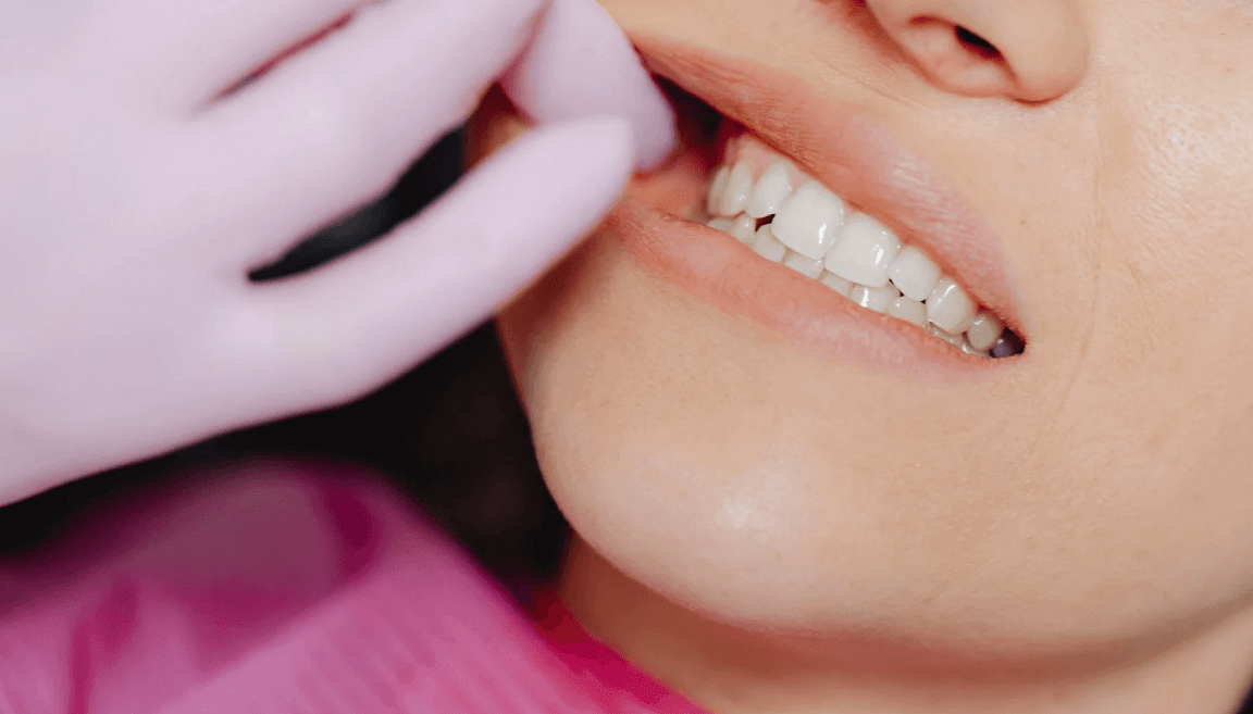 What Happens During a Tooth Restoration Procedure
